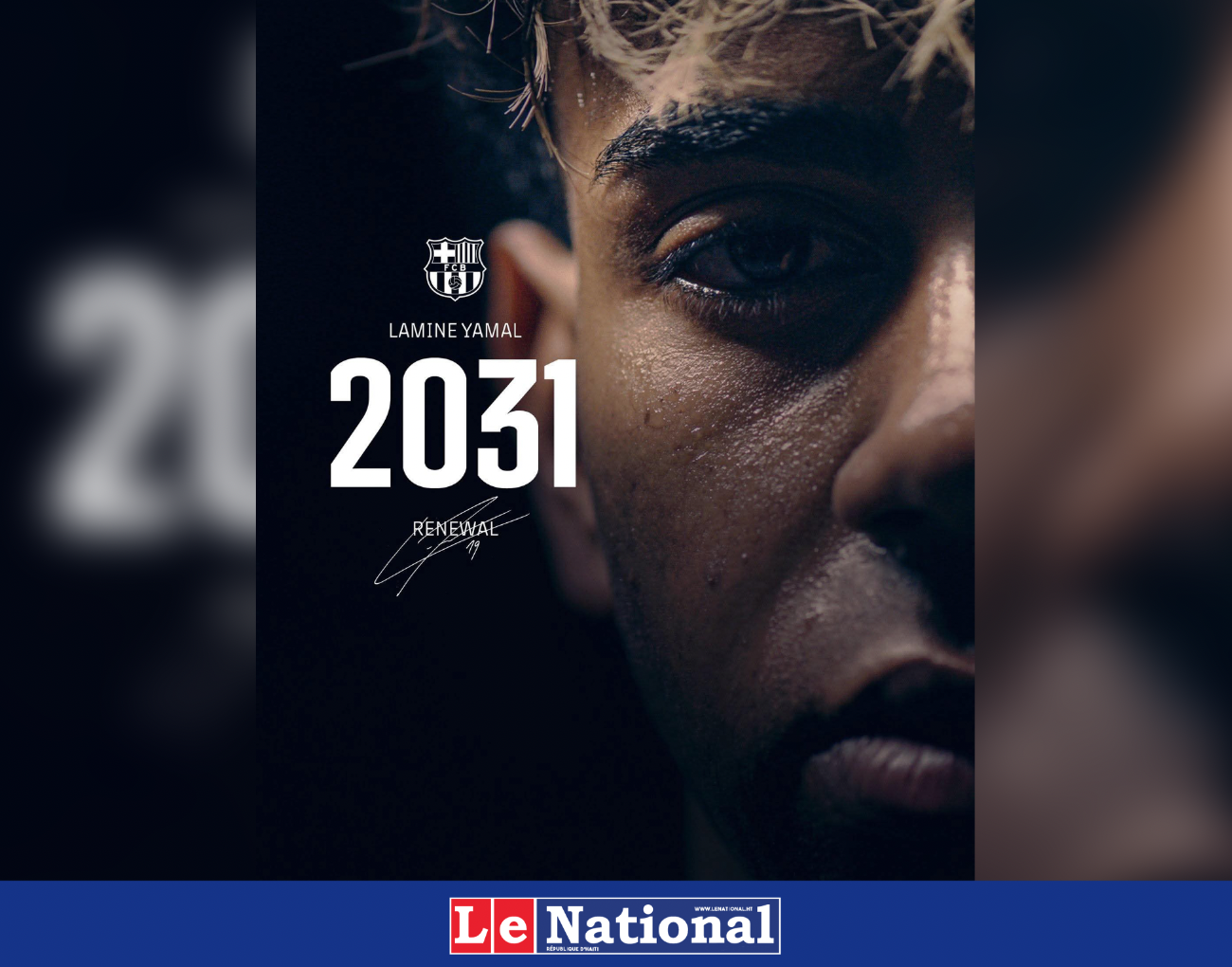 Lamine Yamal, le joyau verrouillé jusqu’en 2031